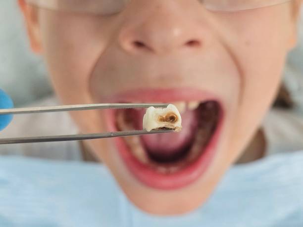 Best Urgent Dental Care for Toothache in Long Grove, IA